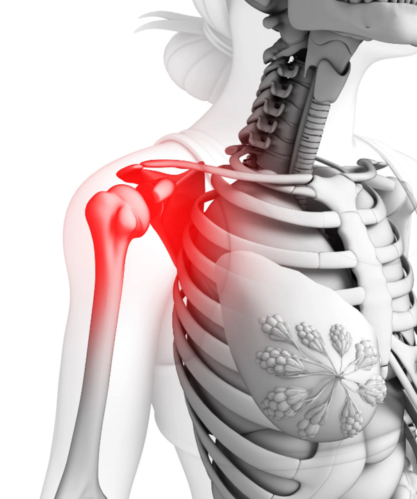 Slap syndrome douleur epaule argenteuil